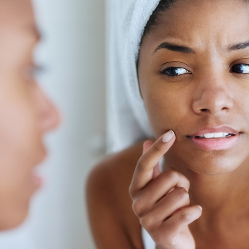 What causes breakouts?